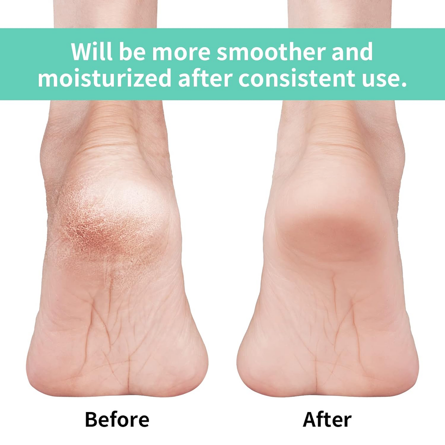 Anti Crack Silicon Gel Heel Moisturizing Socks for Foot Care Men Women (Loose Pack)